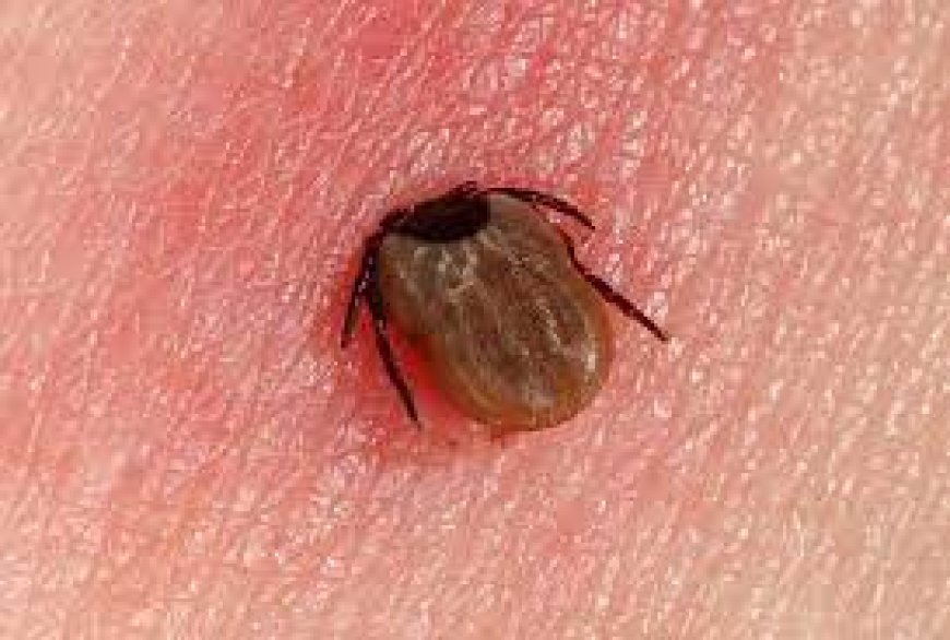 Lyme Disease