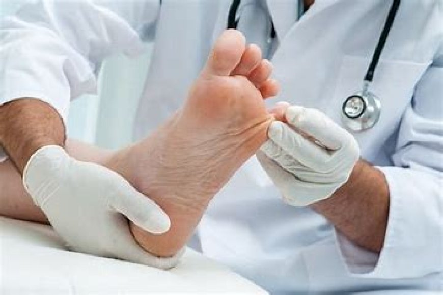 Foot Care for People with Diabetes