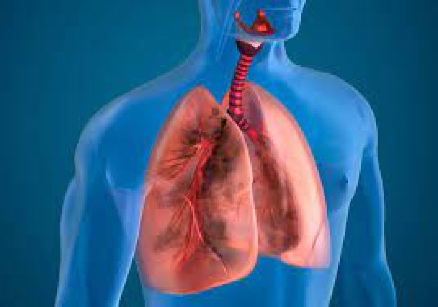 Lung Diseases (Respiratory Problems)