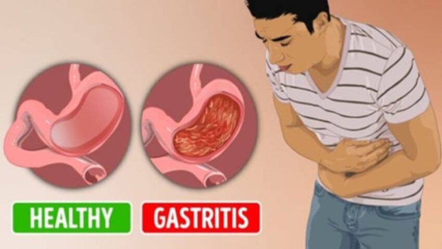 Gastritis