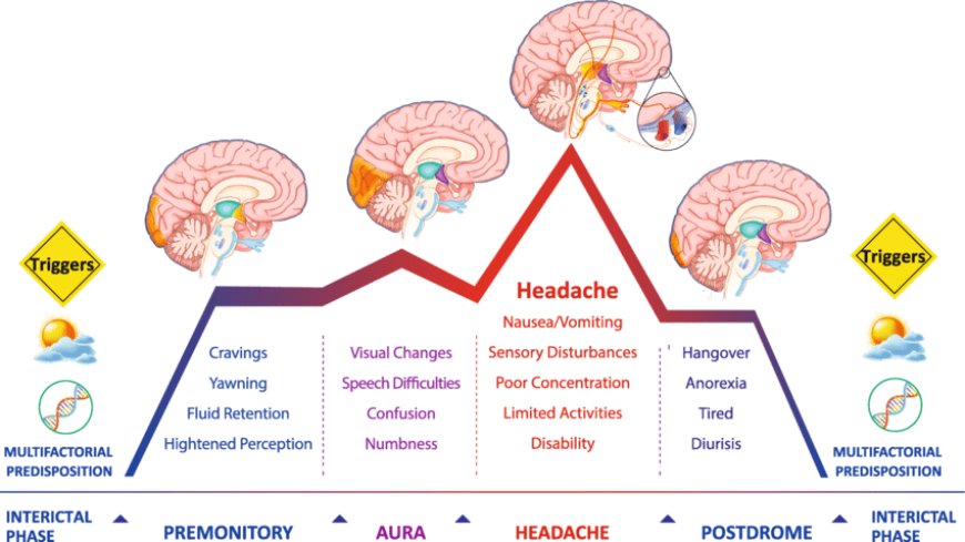 Cyclic Migraines