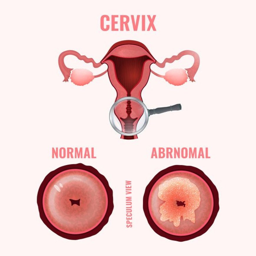 Abnormal Pap Test