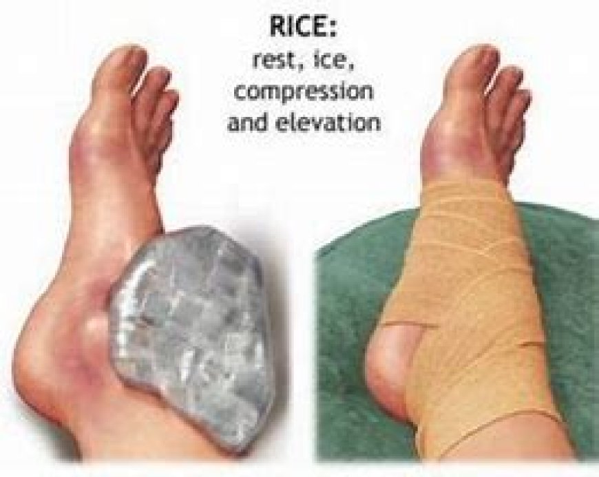 RICE method for minor injuries