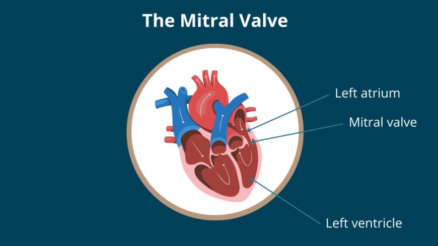 Mitral Valve Prolapse