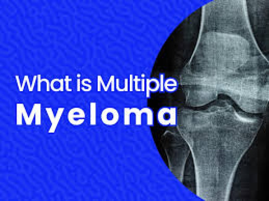 Multiple Myeloma