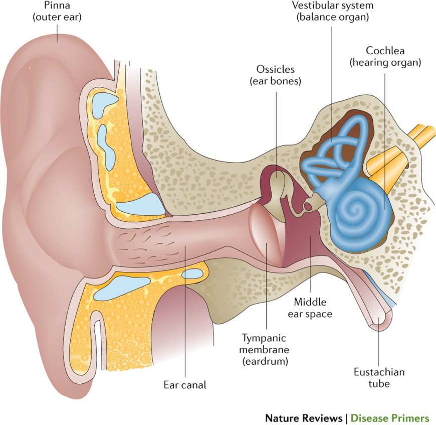 Otitis media