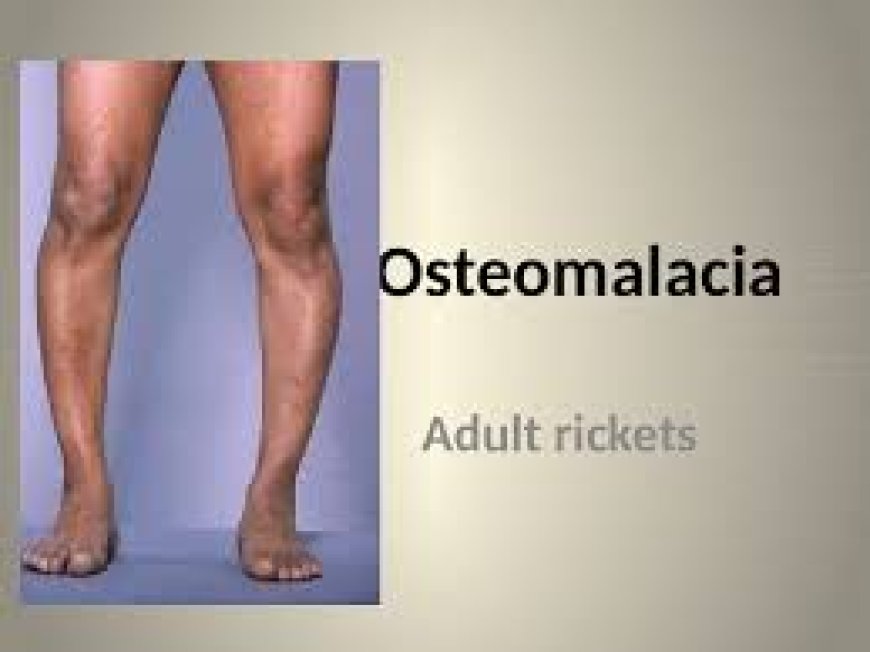 Osteomalacia