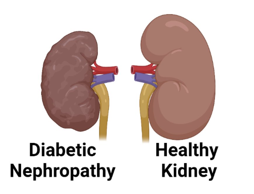 Nephropathy Diabetic