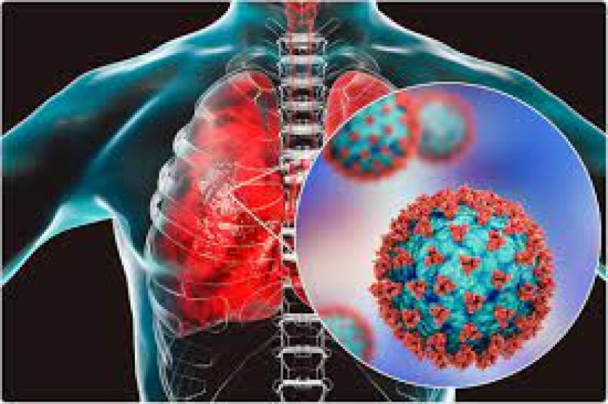 SARS (Severe Acute Respiratory Syndrome)