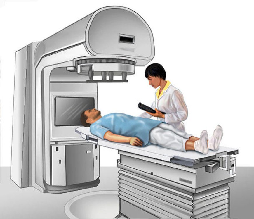 Radiation Therapy for cancer