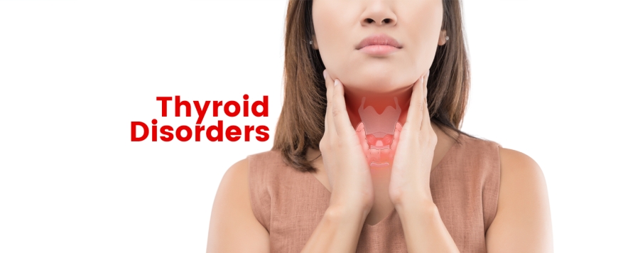 Thyroid Disorders