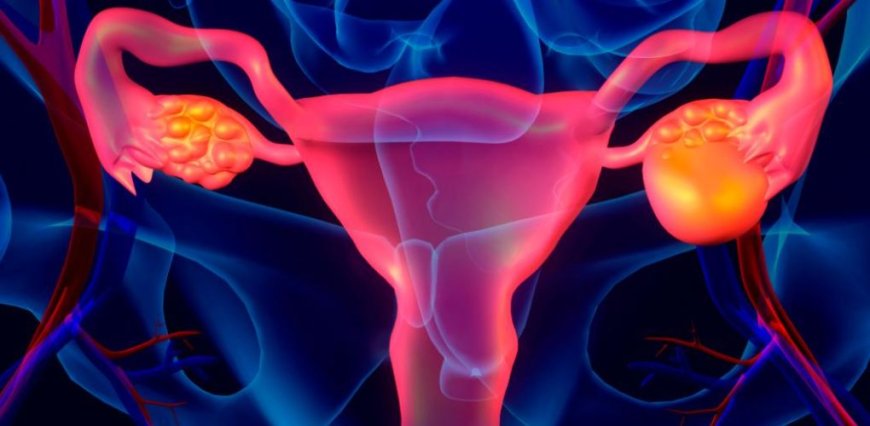 Uterine Cancer