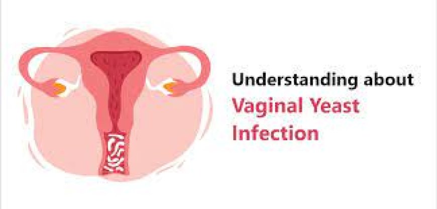 Yeast Infection (vaginal)